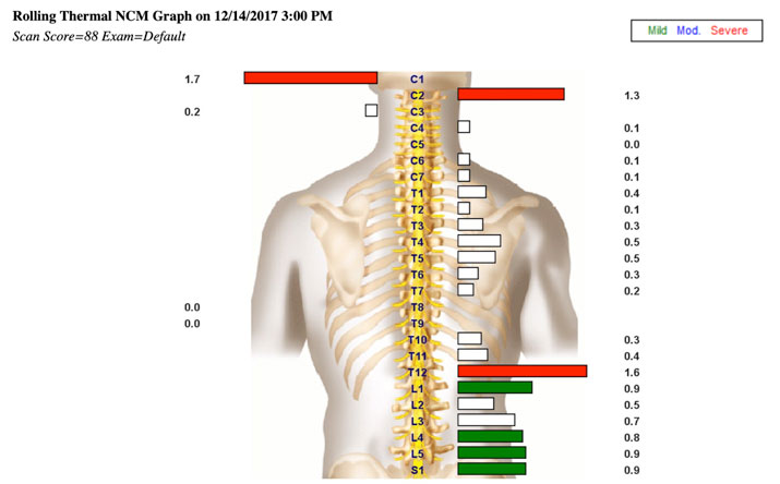 Chiropractic American Fork UT Neurostructural Chiropractic Examination